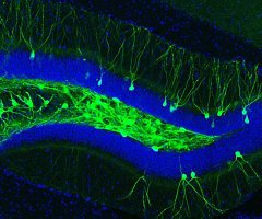 La luz permite recuperar la memoria de animales con alzhéimer
