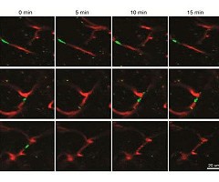 Un nuevo enfoque para tratar el Alzheimer muestra efectividad en modelos animales