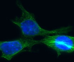 La proteína p38, la salvadora de las células del cáncer de mama ‘in extremis’