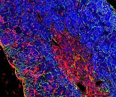 Científicos españoles generan leucemia de linfocitos T 'in vivo' a partir de una célula sana