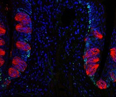 Cómo la obesidad afecta al gusto