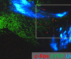Una técnica permite manipular el cerebro con luz y sin cirugía