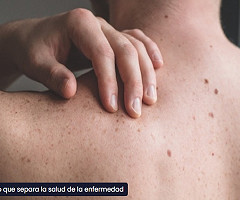 El milímetro que separa la salud de la enfermedad (Podcast)