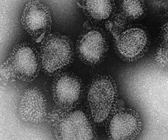 Algunas cepas de la gripe generan daño cerebral y problemas de memoria en ratones