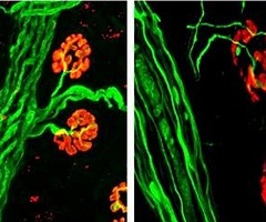Un hidrogel restaura la respiración después de la lesión de la médula espinal en modelos animales