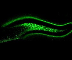 Un grupo de neuronas podrían ayudarnos a conseguir una alimentación equilibrada