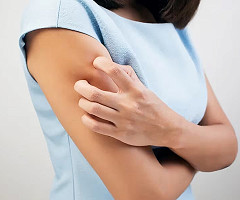 Los expertos de Harvard develaron el misterio de por qué pica la piel