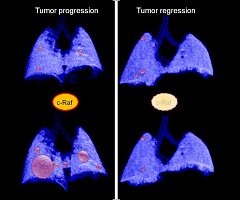 Una terapia genética induce la regresión de tumores de pulmón en ratones